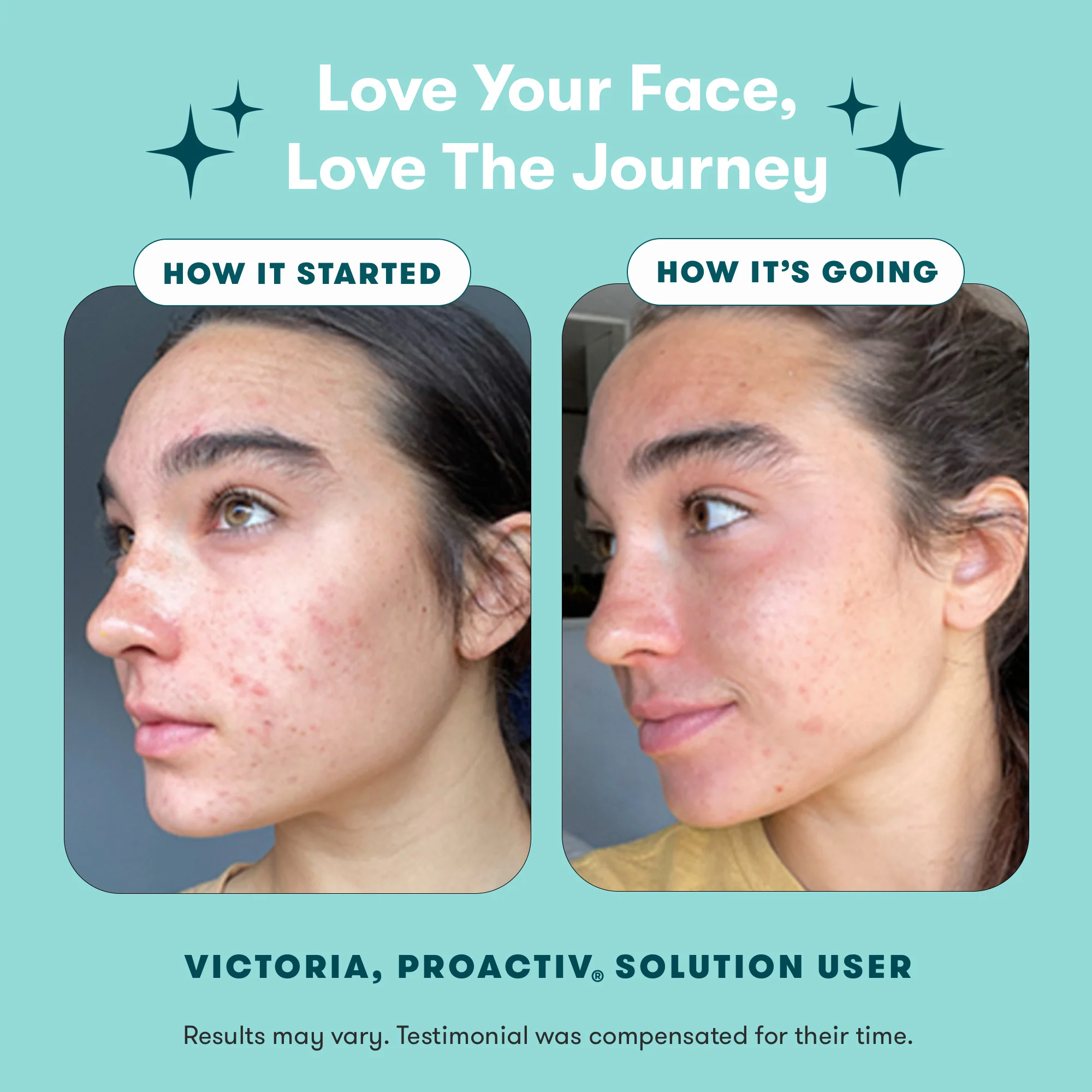 Proactiv Solution® 3-Step Routine - Image 5