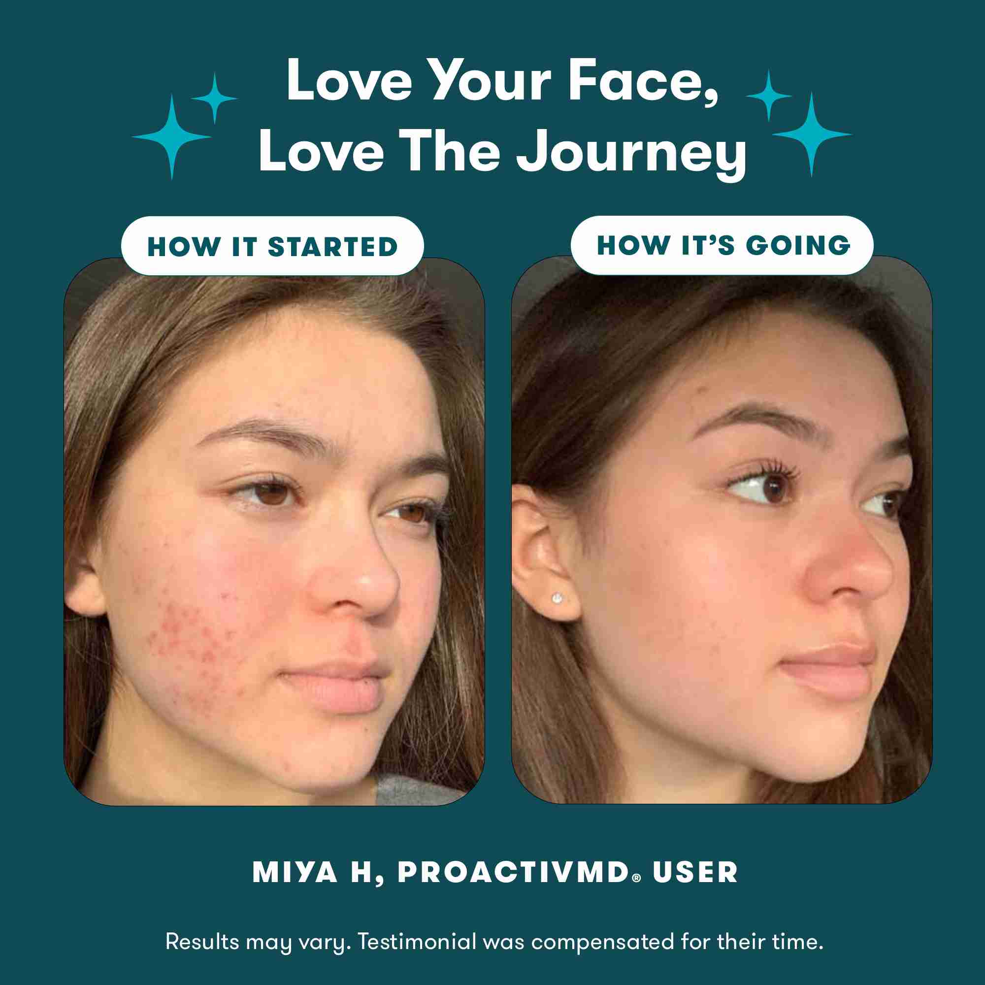 ProactivMD® 3-Step Routine - Image 10